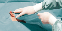 Foliodrape Protect HNO-/MKG-Set II 2