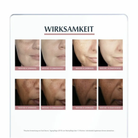 Eucerin® Anti-Pigment Dual Serum – Gegen Pigmentfl
